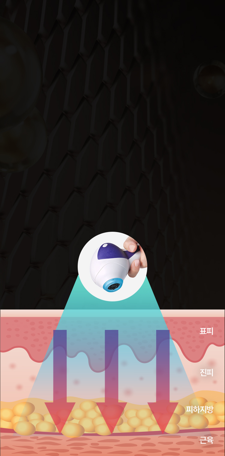 튠페이스 통증 최소화 및 아이스 쿨링 시스템 설명 배경 이미지