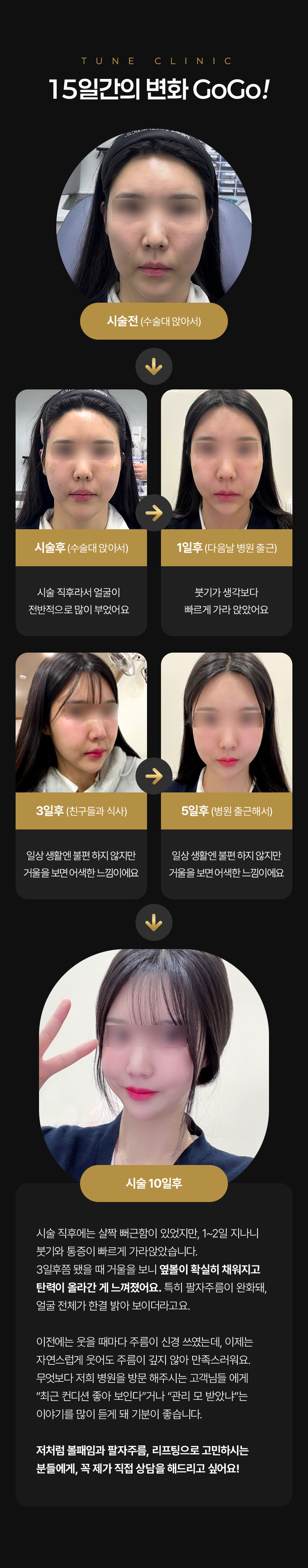 압구정 피부관리 강남 피부과 튠클리닉 볼패임 리프팅 리얼 고객 후기